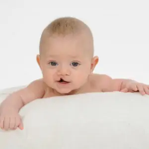 Whom to consult for a kid with cleft lip