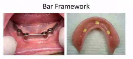 Bar Framework