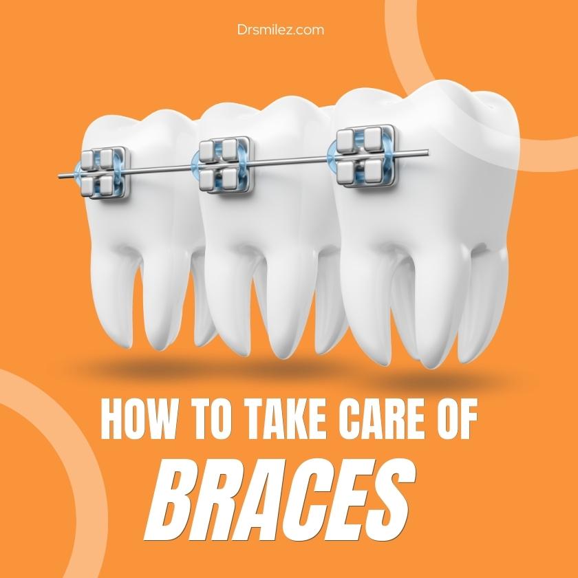 How to Take Care of Your Braces